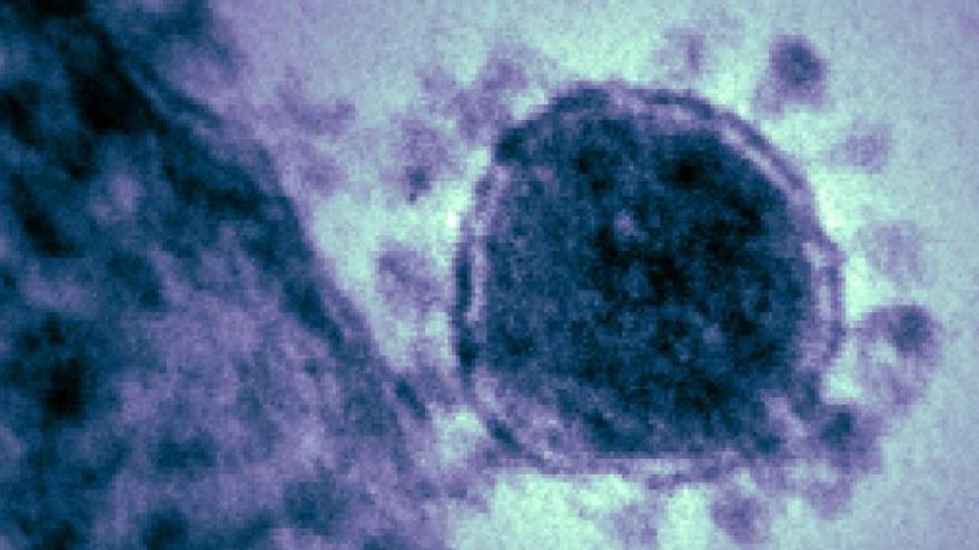 Imagen de un coronavirus.