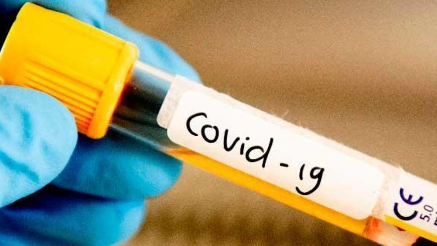Baleares alcanzará los mil casos oficiales de coronavirus este mes