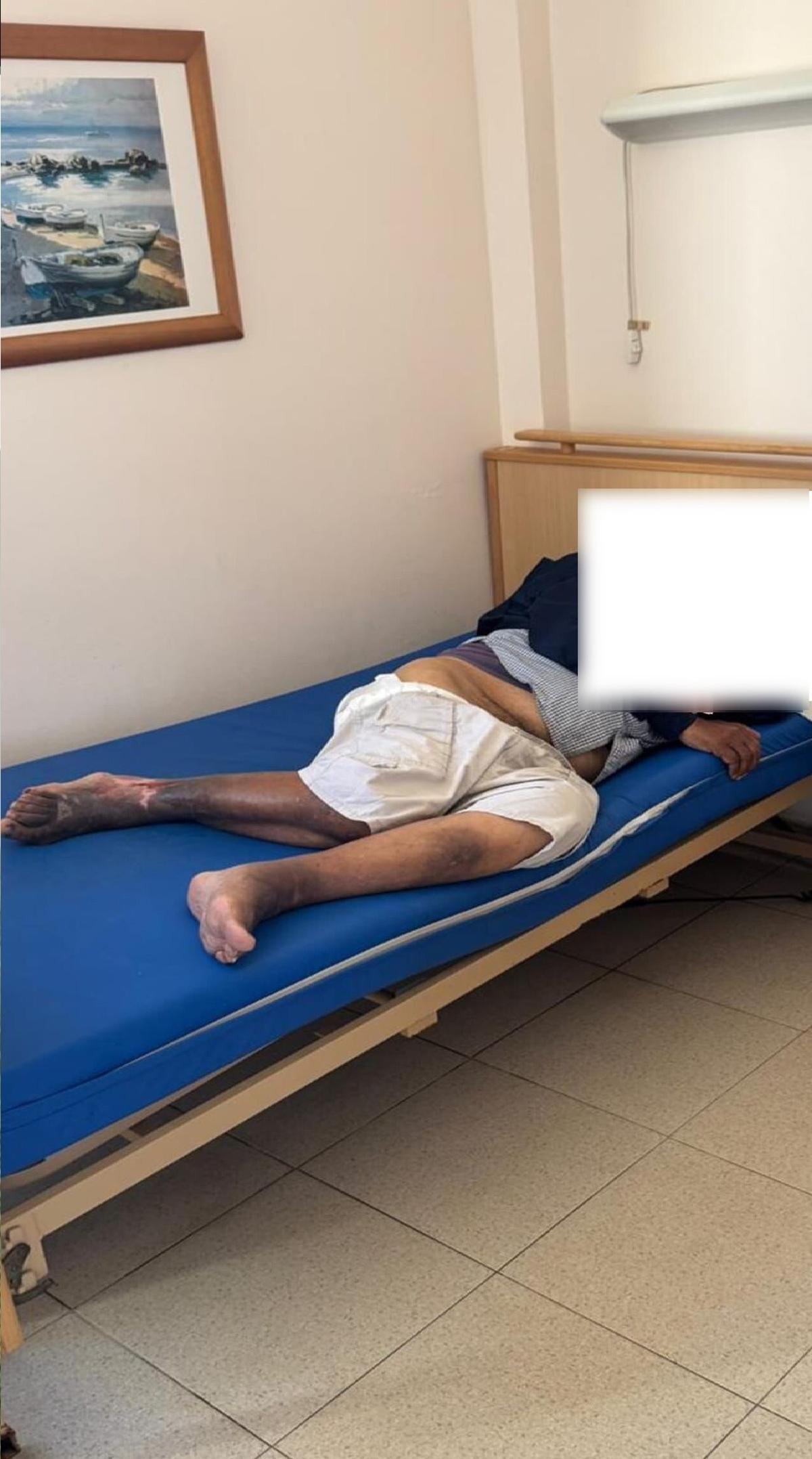 Un anciano con heridas sobre un colchón sin sábanas en la residencia Amavir en Tías.