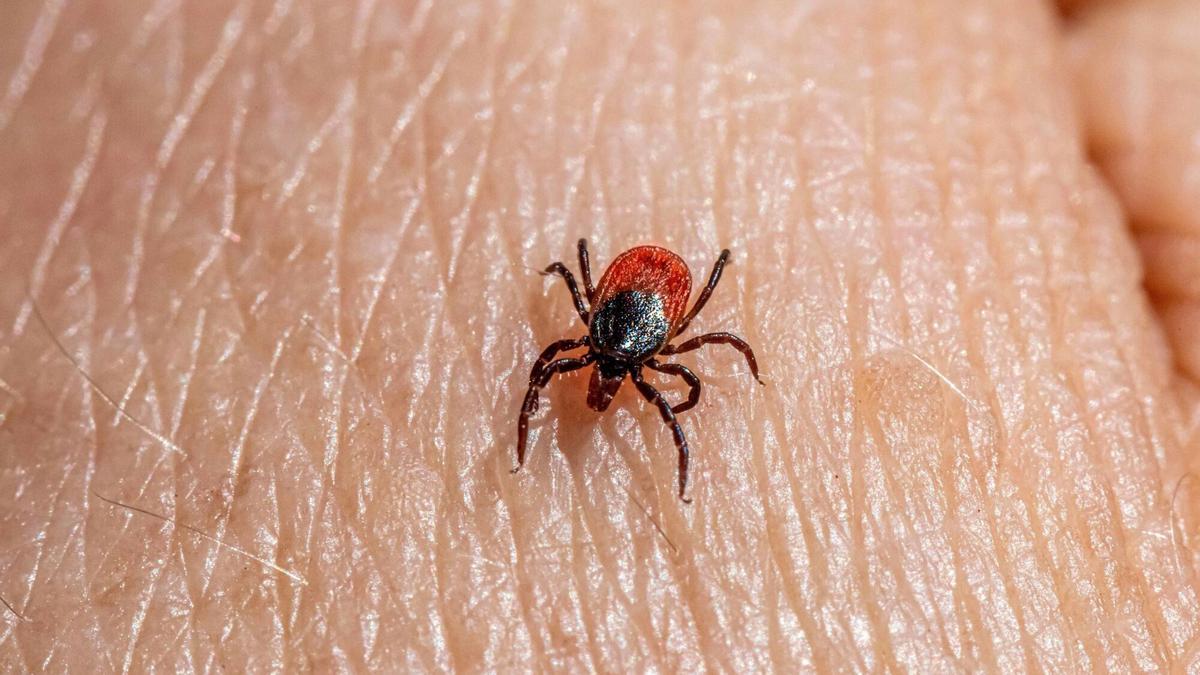 Garrapata sobre piel humana.