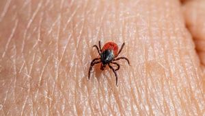 Garrapata sobre piel humana.