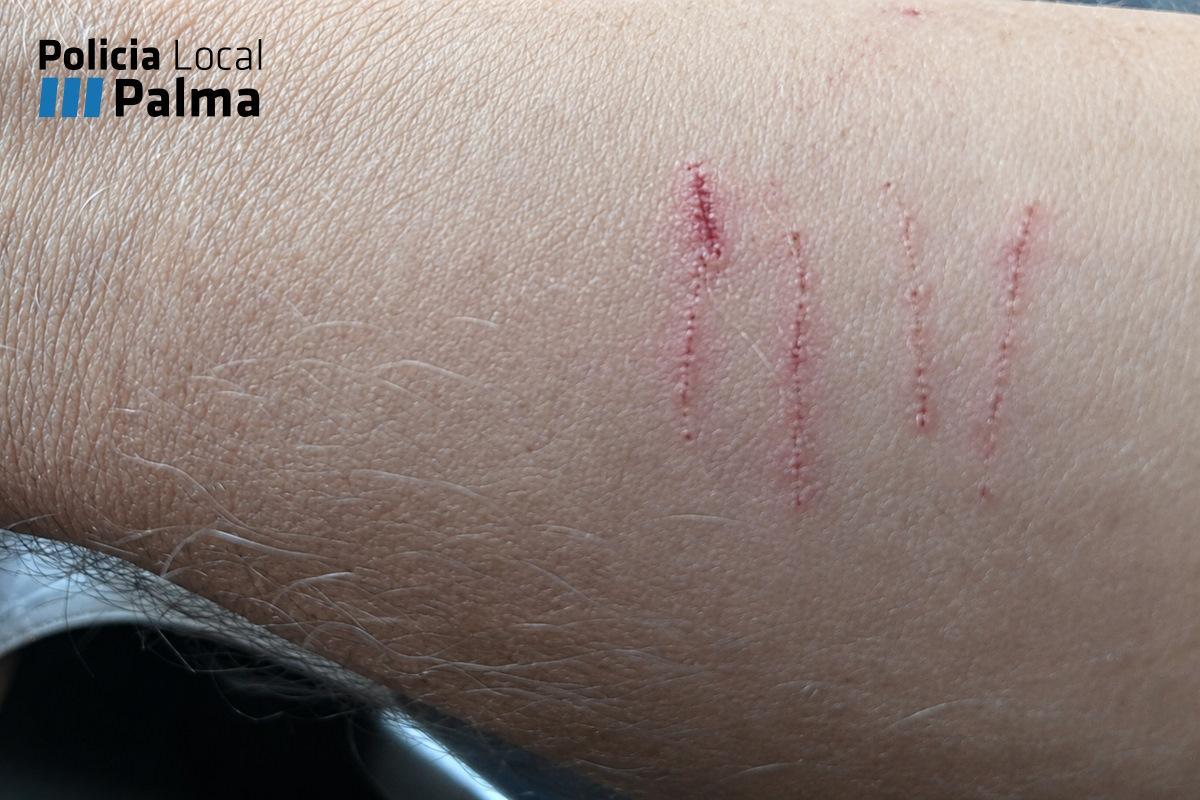 El animal causó lesiones en un brazo a un policía.