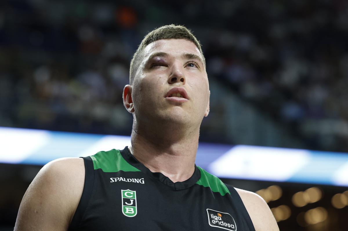 El rostro de Joel Parra, jugador del Joventut que sufrió en el primer partido un gran golpe en su ojo.