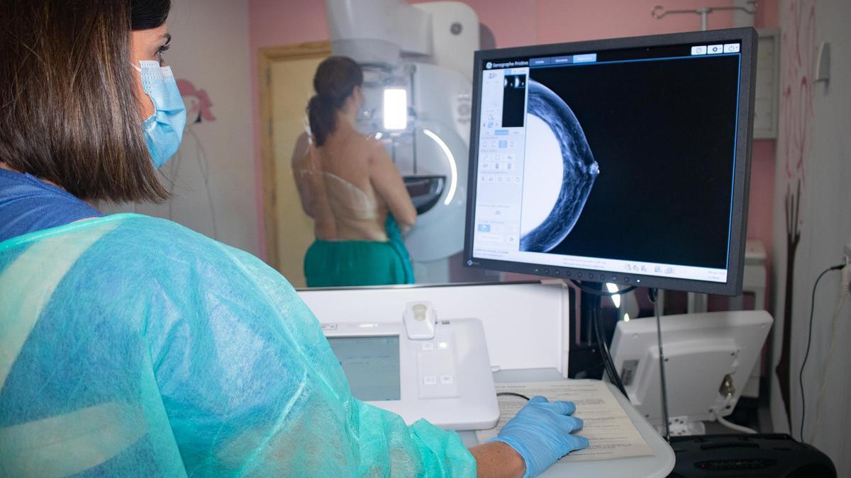 El cribado del cáncer de mama puede ayudar a reducir la incidencia y mortalidad del tumor de pulmón en mujeres