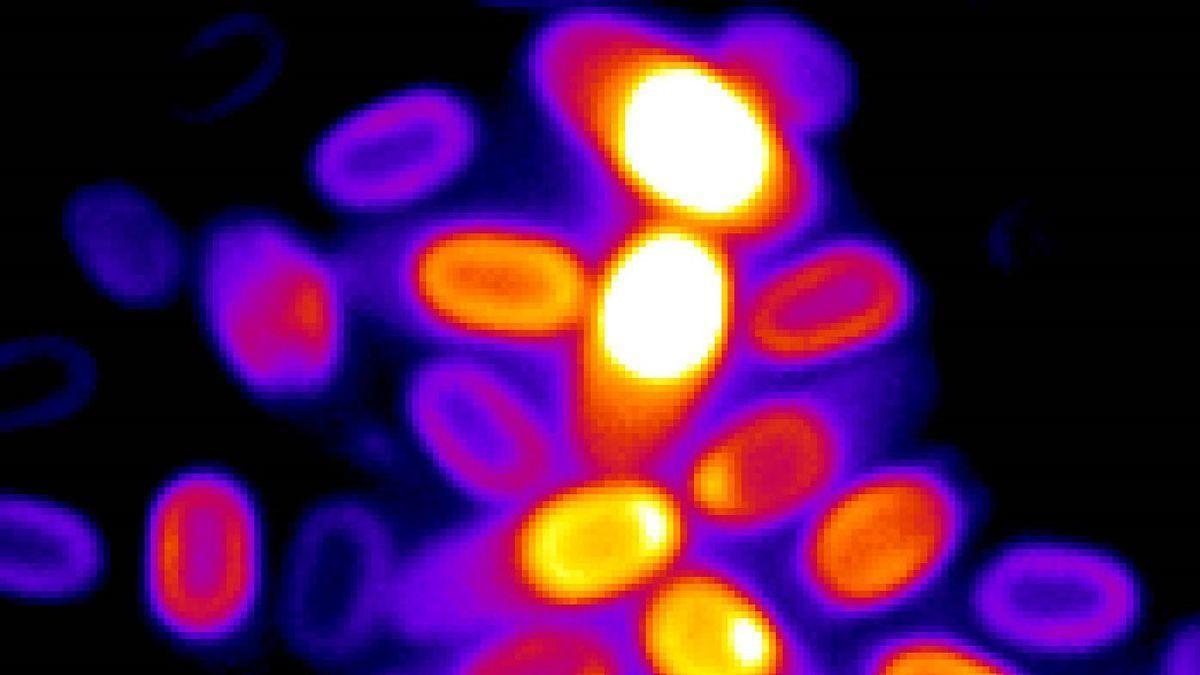Imagen de microscopía de varias esporas con su potencial electroquímico codificado por colores.