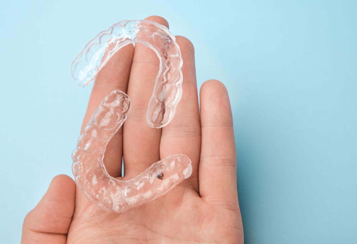 La ortodoncia invisible consiste en férulas transparentes que permiten alinear los dientes de forma más discreta. | SHUTTERSTOCK