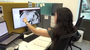 El Hospital Vall d'Hebron desarrolla una IA para analizar tumores hepáticos