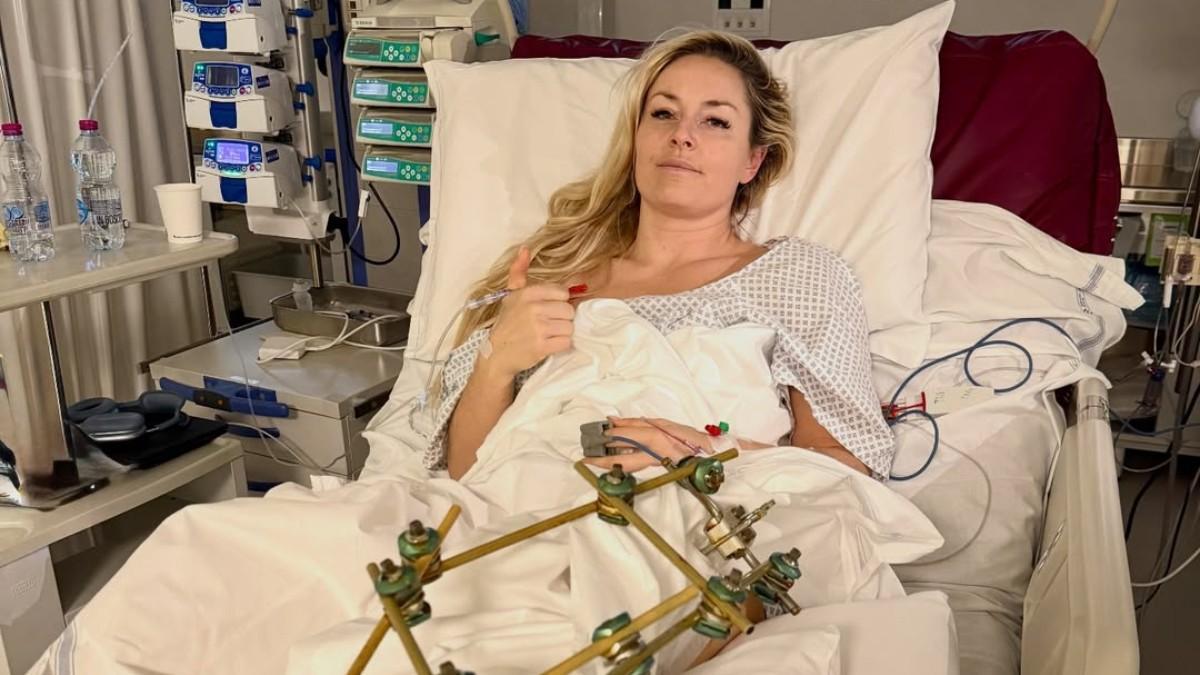 Lindsey Vonn, tras sus tres operaciones en la pierna