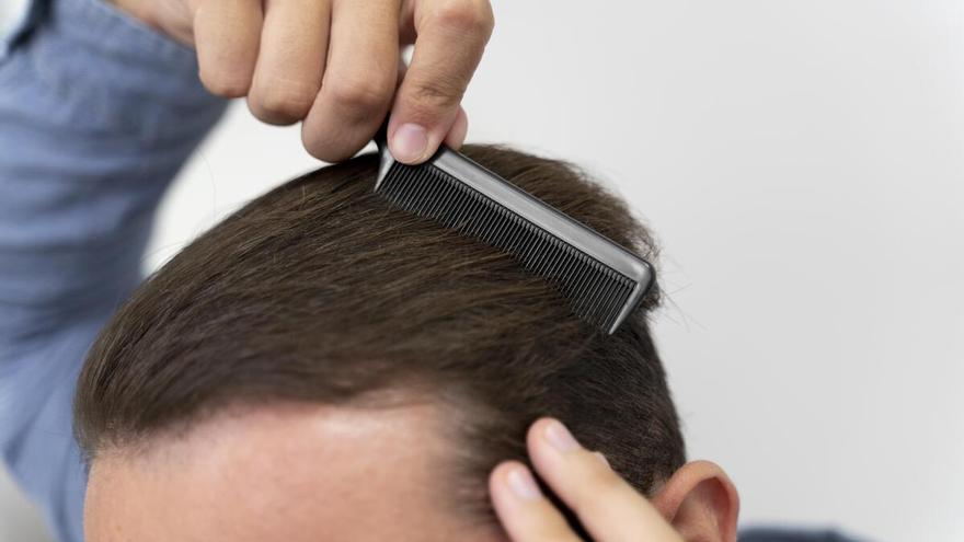 Un método eficaz para evitar la caída del cabello es nunca dormir con el pelo mojado