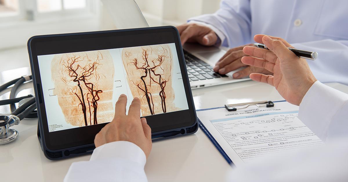 El ictus isquémico, el más frecuente.