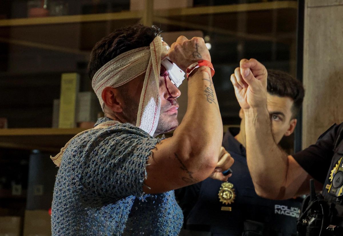 Agentes inspeccionan las heridas de un hombre fruto de una pelea.