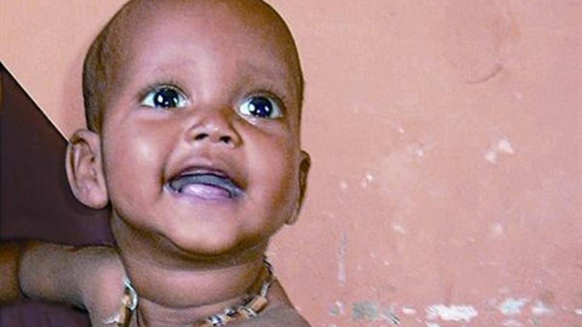 La evolución de Mohamed33 La foto superior muestra a Mohamed desnutrido y aquejado de diarrea en el momento de llegar al centro de atención que Oxfam Internacional tiene en Mogadiscio, la capital de Somalia. Debajo, Mohamed visiblemente recuperado se