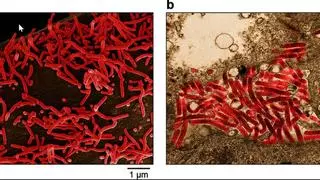 Las claves del virus de Marburgo: síntomas, formas de transmisión y tratamiento