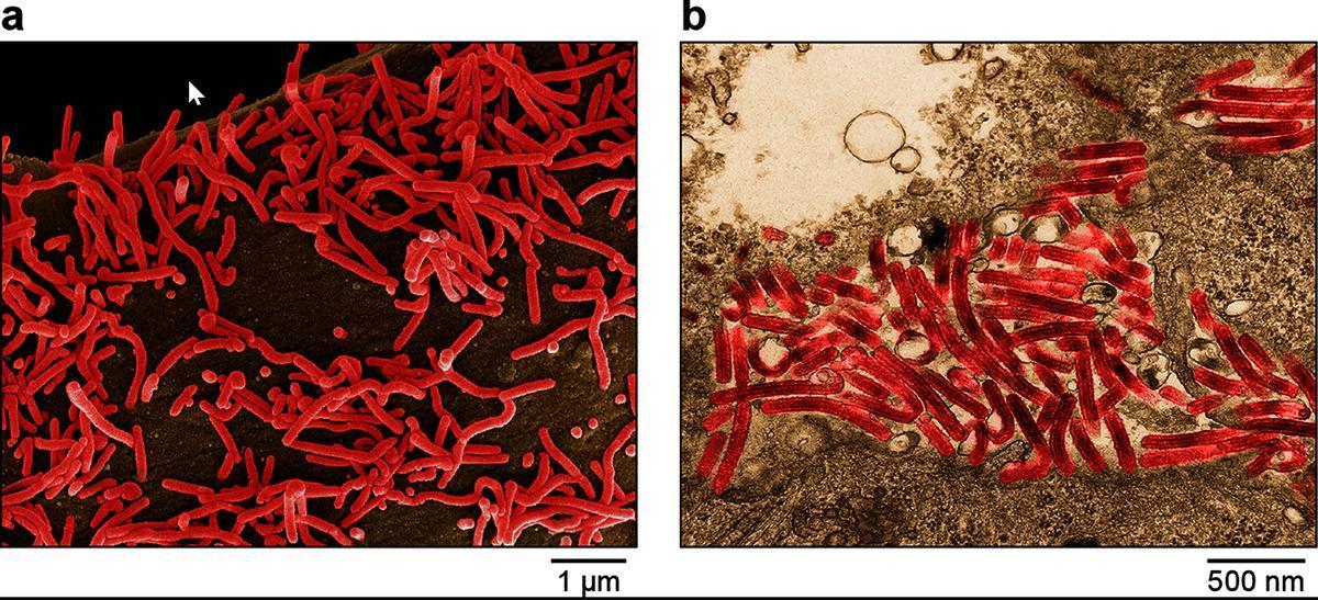 Imagen detallada del virus de Marburgo