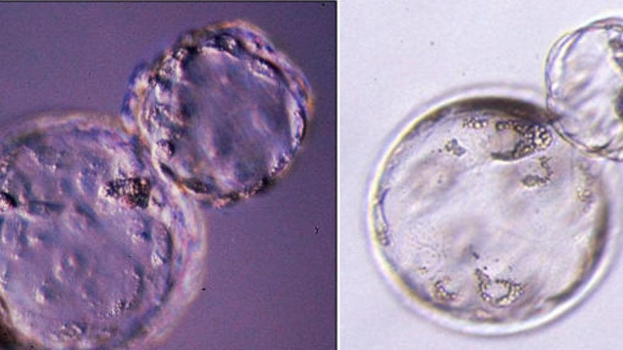 Científicos de la UMU detectan los riesgos de los nacimientos in vitro