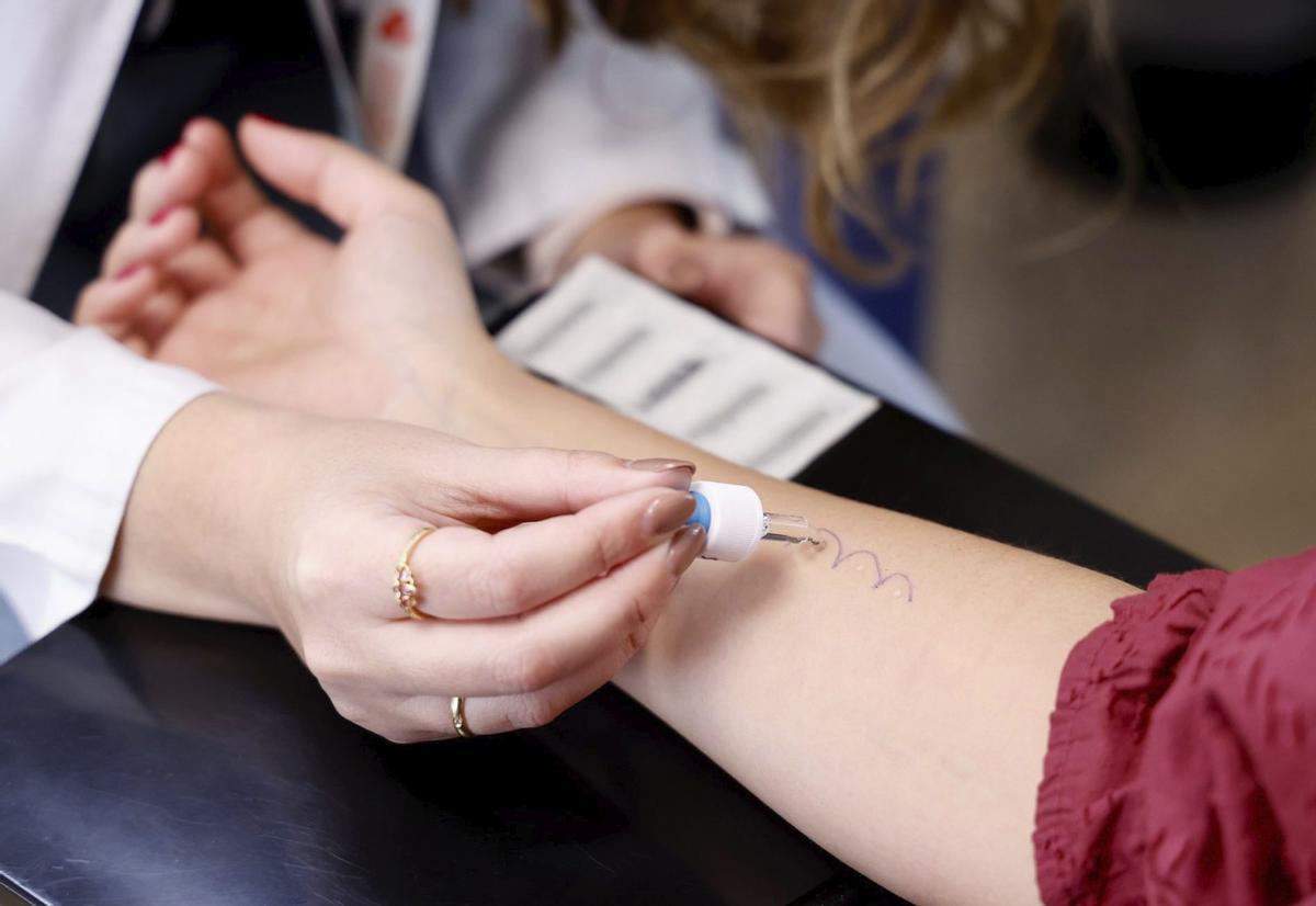 Una prueba de alergias en un centro hospitalario.
