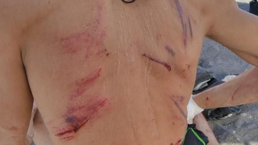 Heridas sufridas por el agredido