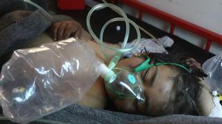 Un ataque químico masacra a más de 70 civiles en Siria