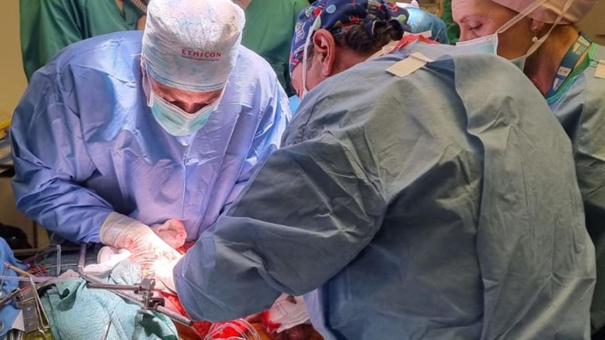 Un equipo quirúrgico del Chuac, durante una cirugía de tumor renal con afectación vascular.