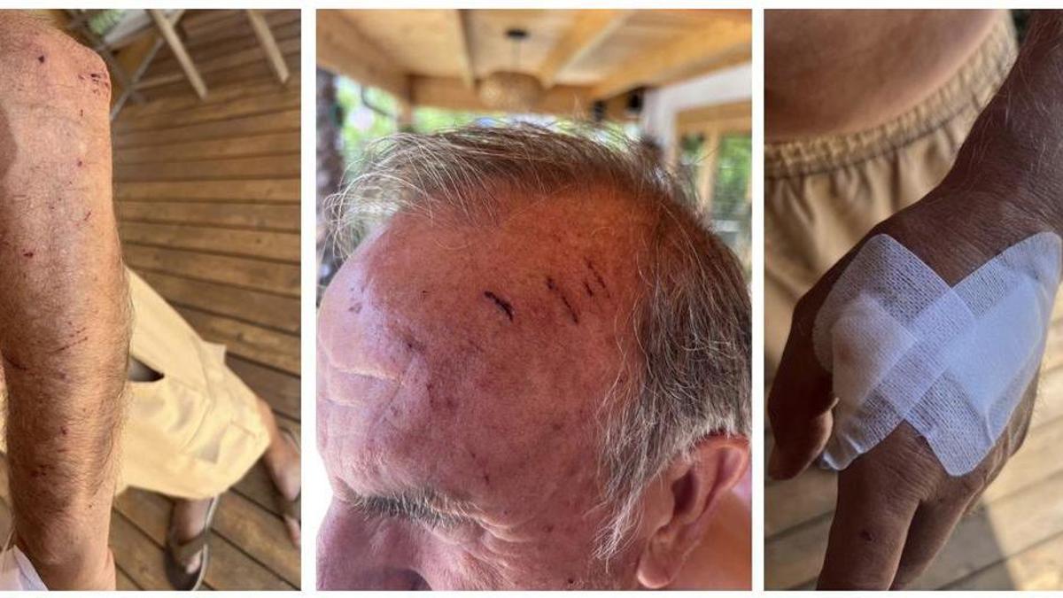 Un anciano herido tras caer en un solar sin vallar de Sant Josep de la Vall