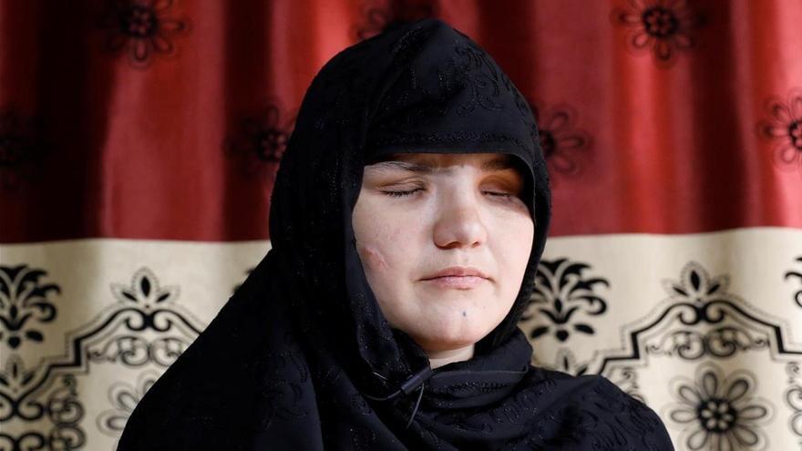Khatera, ciega por querer trabajar fuera de casa en Afganistán