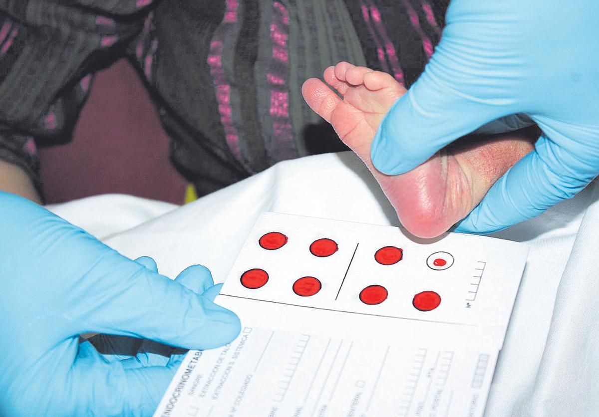 Prueba del talón a un recién nacido para encontrar precozmente enfermedades congénitas.