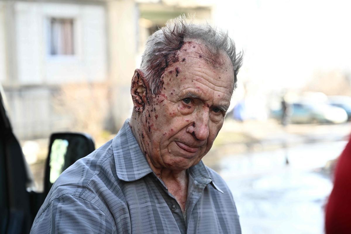 Un hombre herido se encuentra junto a un vehículo de una unidad de emergencia para recibir asistencia médica después de los bombardeos en la ciudad de Chuguiv, en el este de Ucrania, el 24 de febrero de 2022.