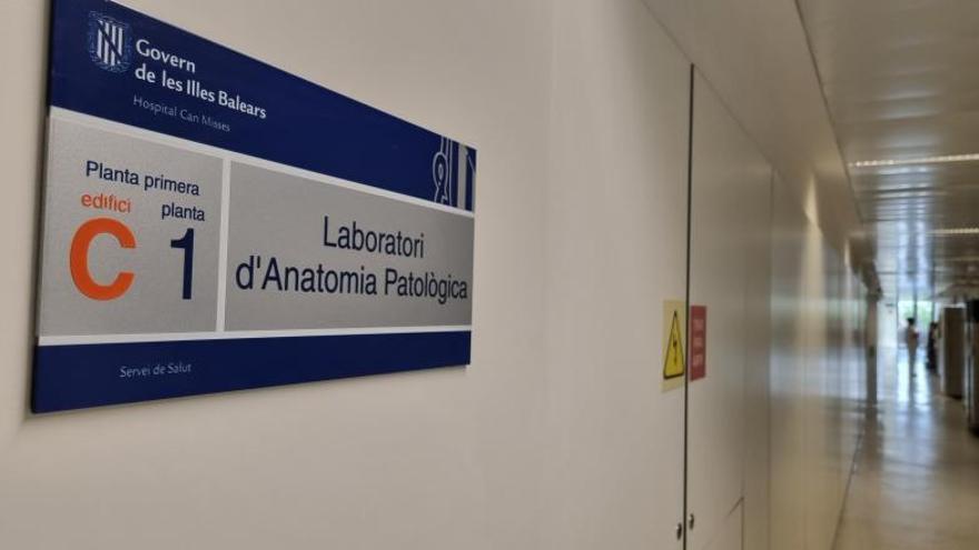 Salud digitalizará las biopsias de Ibiza a través de un macroprocesador que se ubicará en Mallorca