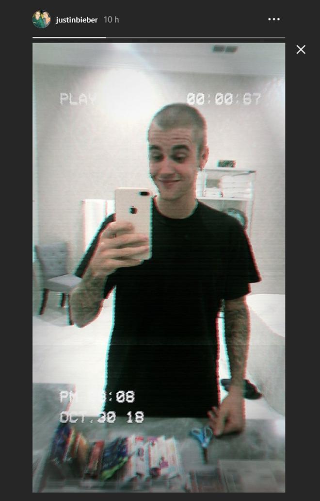 Justin Bieber ha colgado esta foto en su Instagram Stories