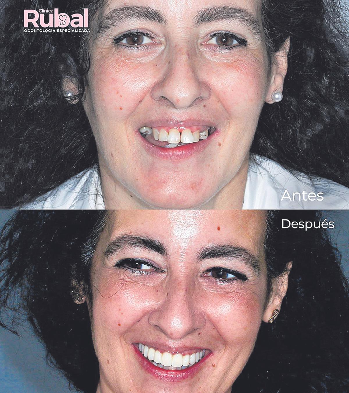 Antes y después del tratamiento a un paciente.