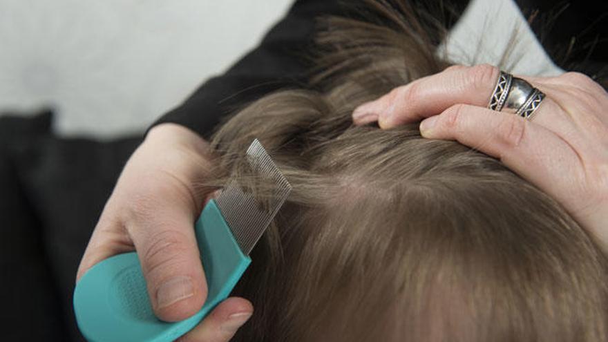 ¡Atención madres y padres! El truco médico para terminar con los piojos