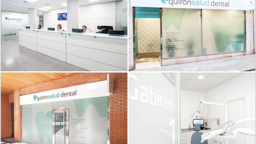 &quot;All-on-4&quot;: Tus Dientes Fijos desde el primer día