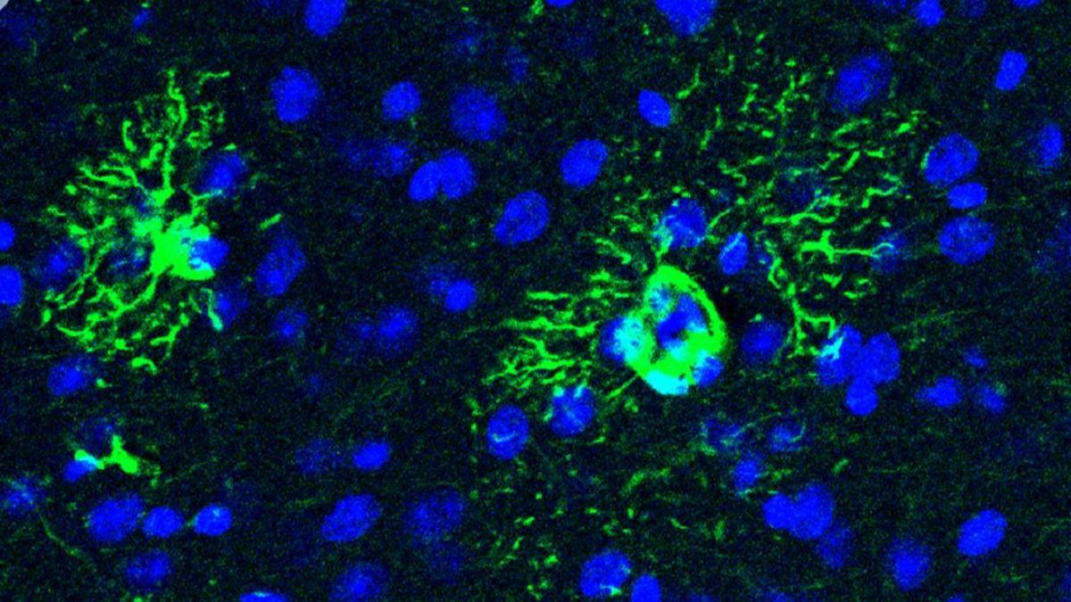 Dos astrocitos (en verde), un tipo de célula que según una investigación del CSIC podrían contribuir al desarrollo de alzhéimer