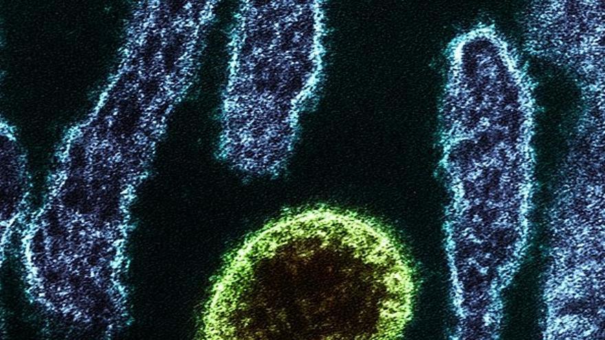 Investigadores chinos identifican un nuevo virus zoonótico con 35 infectados confirmados