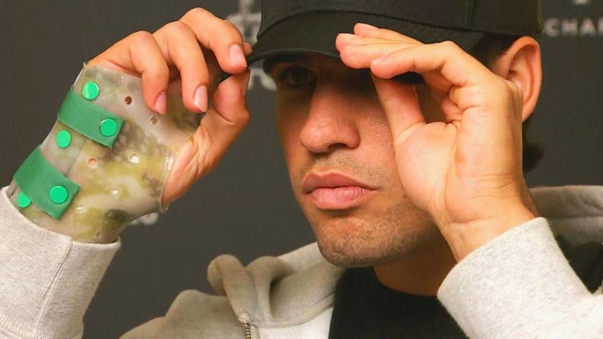 Carlos Alcaraz, ante una lesión peligrosa que requiere mucha cautela