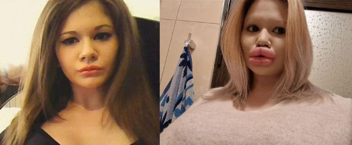 Andrea Ivanova antes y ahora