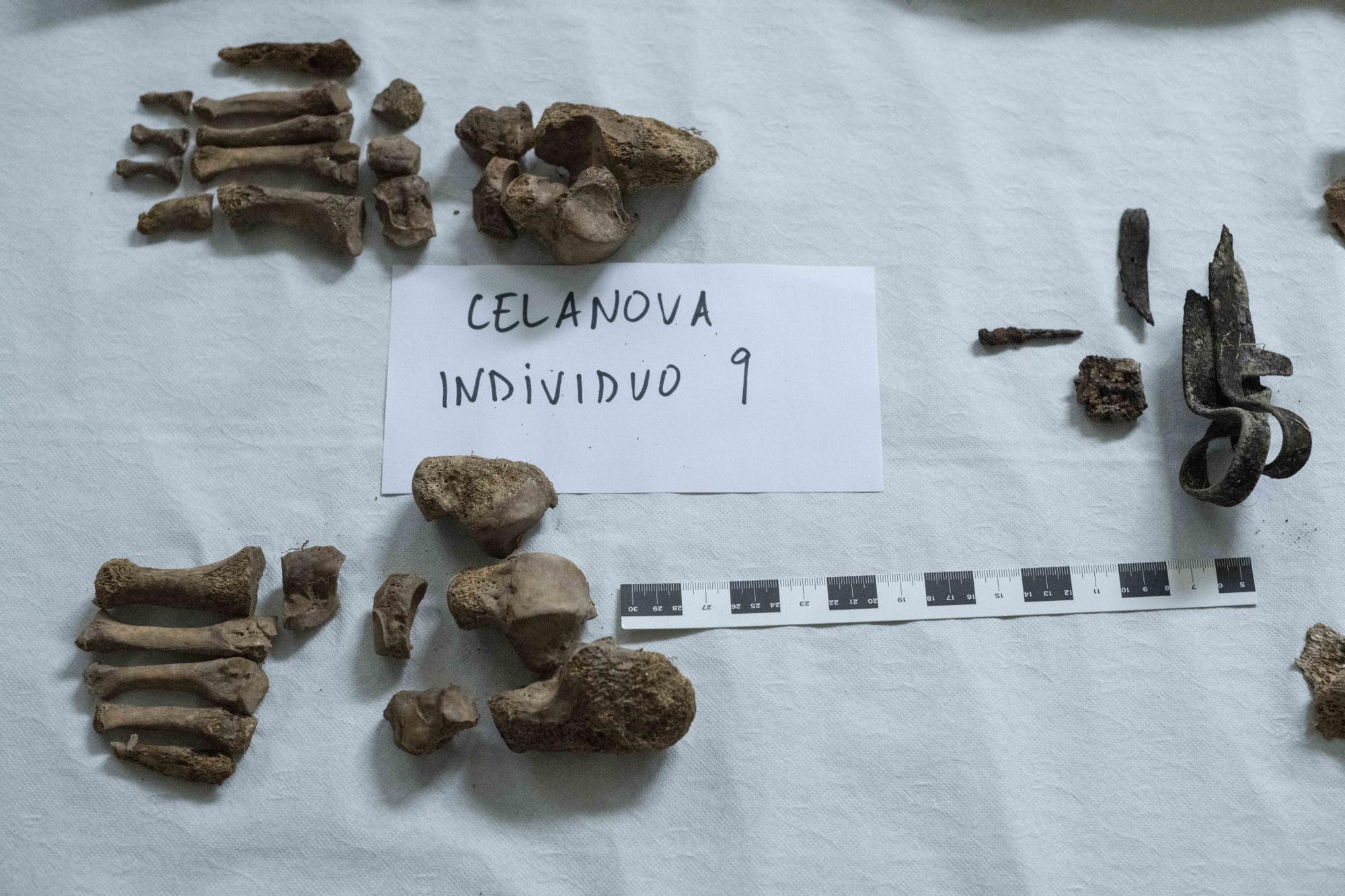 Los huesos de los pies del individuo número 9 de Celanova.