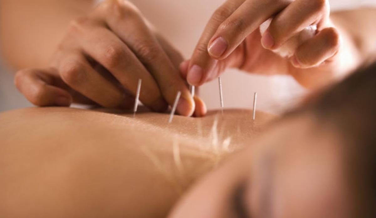 Alternativas naturales al ibuprofeno que deberías tener en cuenta