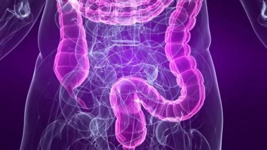 Intestinos y colon