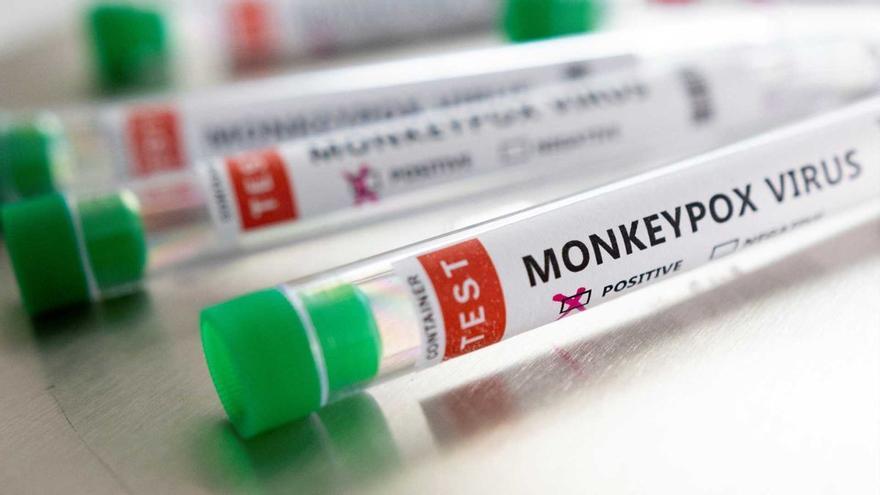 Verola del mico: Per què Espanya és el país amb més contagis?