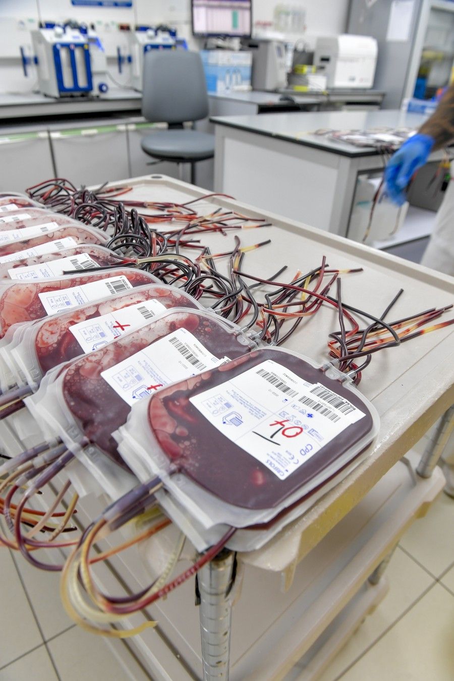 Almacenamiento de las donaciones de sangre en el ICHH