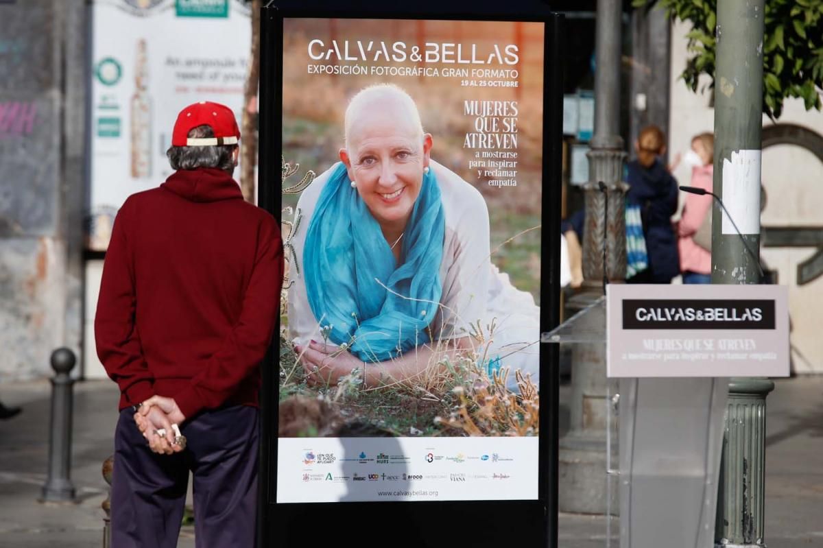 'Calvas y bellas', una invitación a mirar al cáncer a los ojos