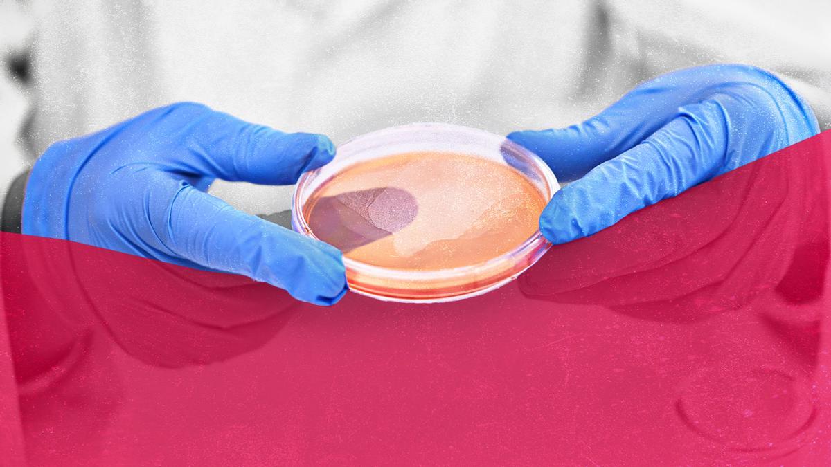 El aumento de las infecciones de transmisión sexual en Asturias preocupa a Salud: &quot;La gonorrea y la sífilis están al alza&quot;