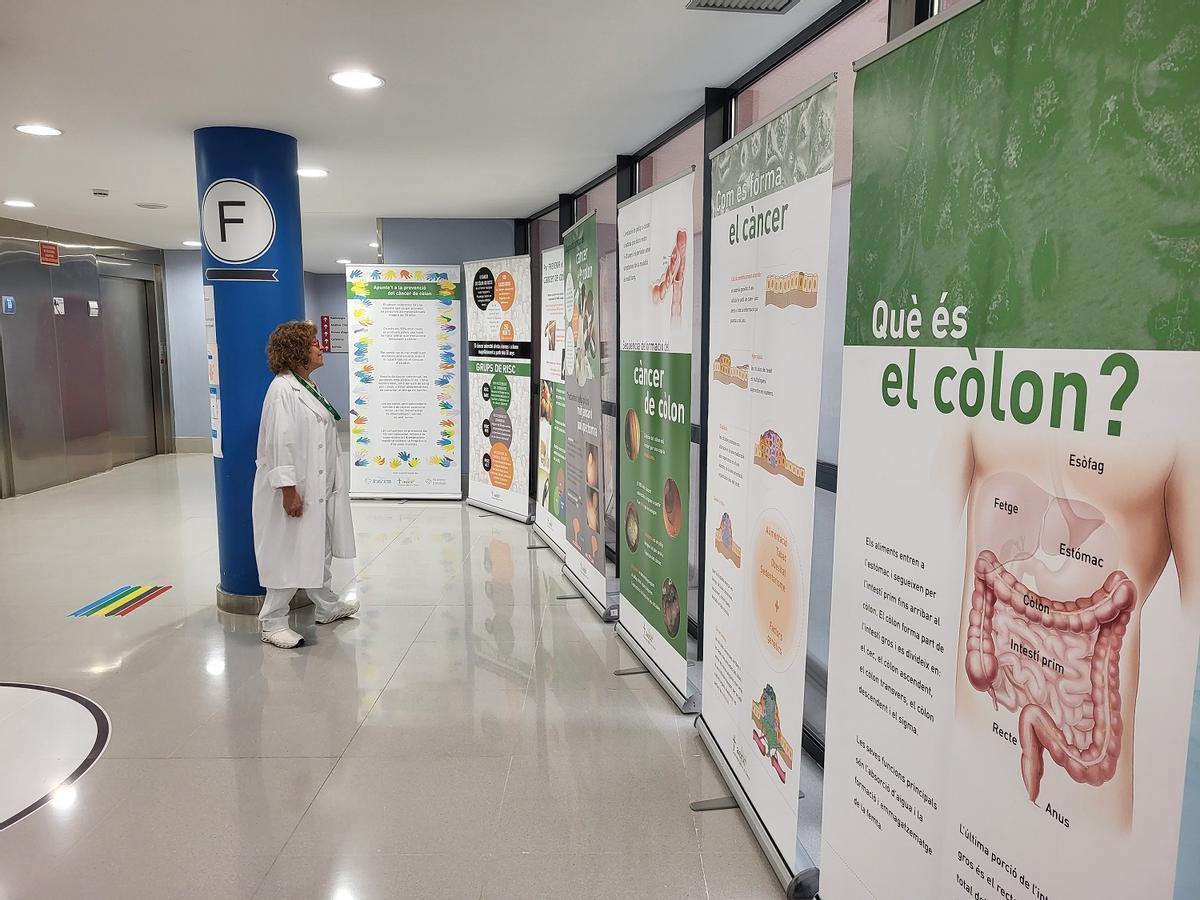 Exposición sobre el cáncer de colon en el Hospital de Figueres. Exposición sobre el cáncer de colon en el Hospital de Figueres.
