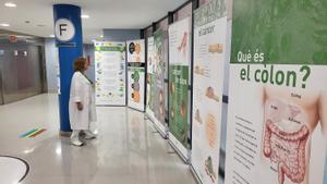 Exposición sobre el cáncer de colon en el Hospital de Figueres.