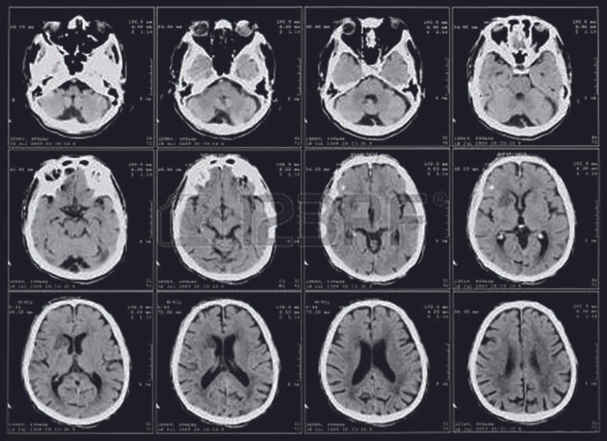 José María Prieto González: Nuestro servicio es un referente nacional en Neurología