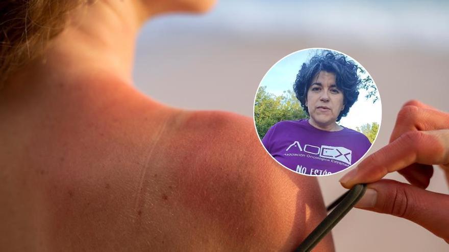 Una campaña de AOEx en Coria acercará recomendaciones para proteger la piel del sol para este verano