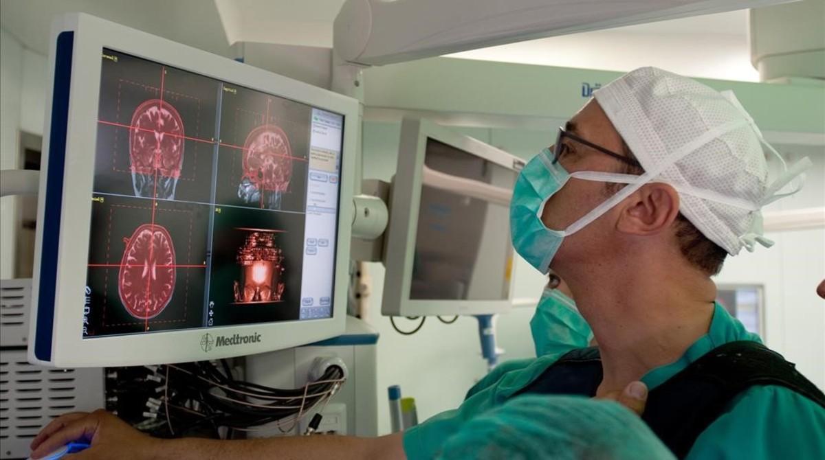 Un neurocirujano observa las imágenes cerebrales de un paciente que sufre epilepsia