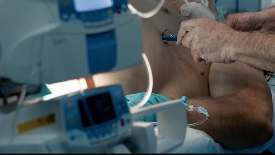 El Reina Sofía, pionero en implantar un desfibrilador sin cables a pacientes que sufrieron muerte súbita