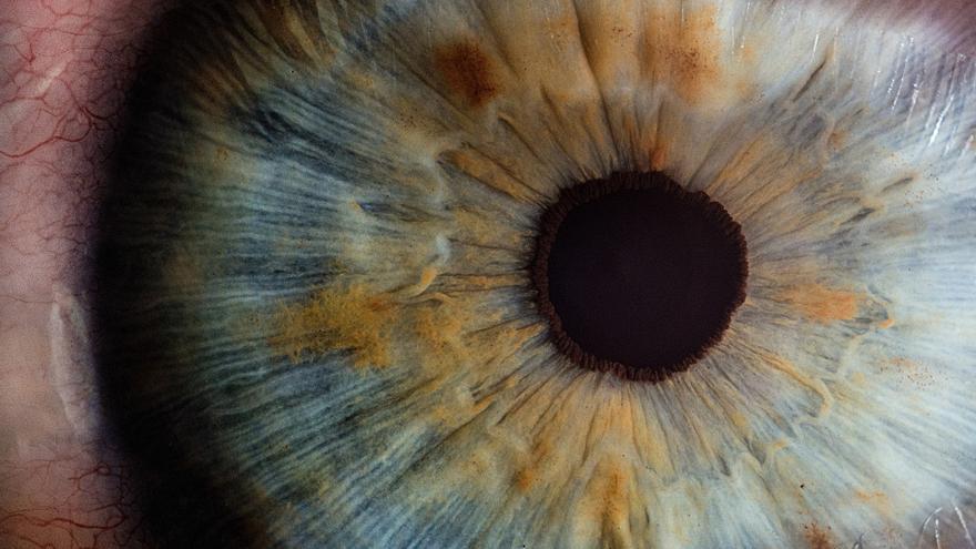 La UMH participa en una investigación europea en busca de tratamientos para la falta de iris